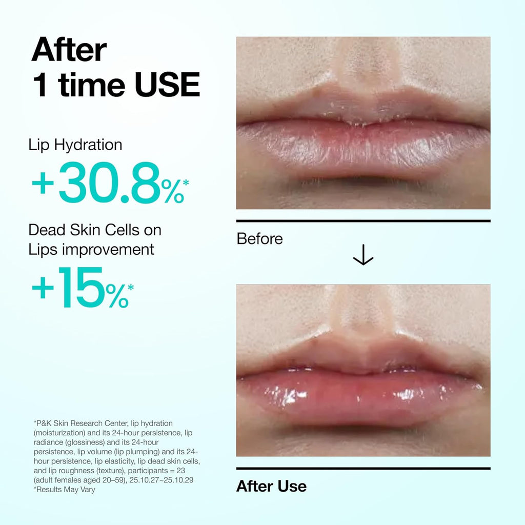PDRN Lip Serum, Long-Lasting Hydration for Dry, Cracked Lips, Non-Sticky Moisturizing Lip Care with Salmon DNA, Hyaluronic Acid & Collagen, Korean Skincare, 0.33 Fl.Oz