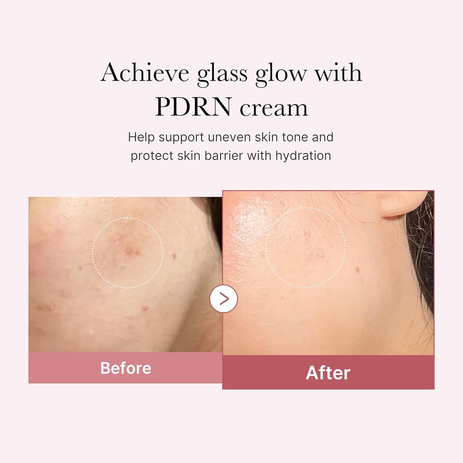 PDRN Pink Hyaluronic Moisturizing Cream | Blemish Recovery, Relief & Hydrating Care | Restores Skin Elasticity & Glow | Korean Skincare for Even Skin Tone & Pore Care | 50Ml / 1.69 Fl.Oz.